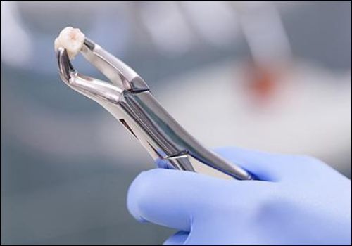 Root canal care in Rajkot: practical insights from a trusted dental hospital