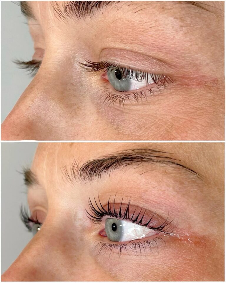 Glow Up: A Realistic Guide to Modern Facial Treatments